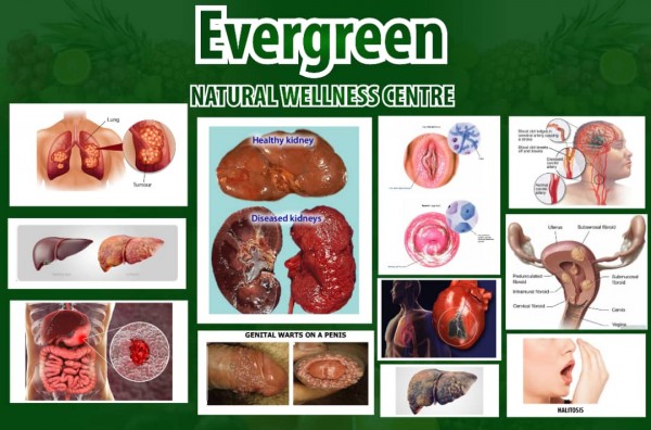 Evergreen Natural Wellness Clinic
