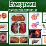 Evergreen Natural Wellness Clinic